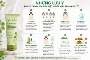 nhung luu y